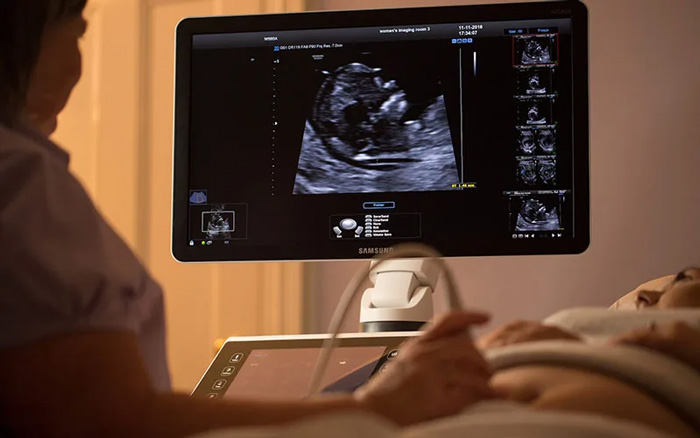 اندازه نرمال سر جنین bpd در سونوگرافی چقدر است؟+ جدول