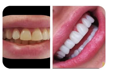 زیبایی دندان ها با خدمات تخصصی کلینیک دندانپزشکی مهر شریعتی در شرق تهران : دیدگاه پزشکی و علمی