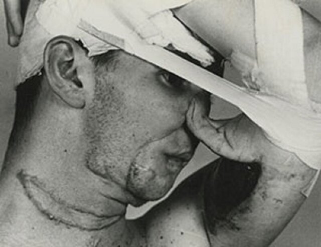 تاریخچه عمل‌های زیبایی/ اولین جراحی زیبایی تاریخ کِی انجام شد؟